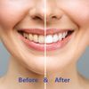 Chomp Super Whitening Toothpaste Tablets with Nano Hydroxyapatite