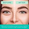 Patchology Restoring Night Eye Gels - Under Eye Patches For Dark Circles and Puffy Eyes Care - Hydrating Eye Mask Patch with Retinol - Eye Bags, Puffiness & Wrinkles Reducer (5 Pairs)