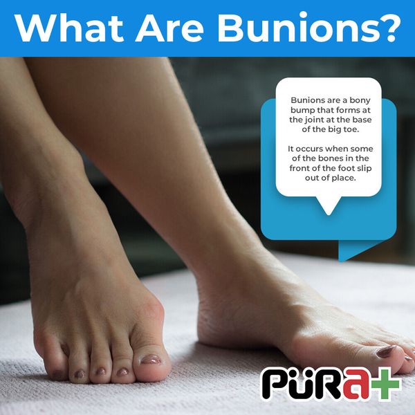 Bunion Corrector | Bunion Relief Protector Sleeves Kit | Hammer Toe Straightener