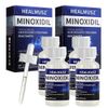 4Pack Minoxidil 5% Extra Strength Hair Regrowth Solution 4 Month Supply For Men