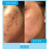 Admire My Skin Dark Spot Corrector Remover for Face - Brightening Discoloration Correcting Serum - Melasma Treatment Cream with Synovea, Kojic Acid, Vitamin C, Salicylic Acid, Lactic Acid Serum