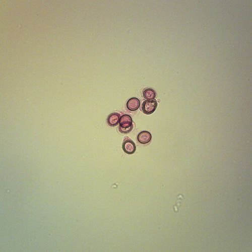 Carolina Tapeworm Proglottids Comparison Slide, Microscope Slide with Mature Proglottids of Dipylidium and Taenia for Comparison, Glass, 600x Magnification