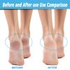 4 Pack Extra Coarse Green Replacement Roller Refills Compatible with Scholl Express Pedi Foot Smoother