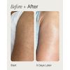 Topicals Slather Exfoliating Body Serum - With Retinol, Squalane, Urea and AHAs for Bumpy, Rough or Textured Skin - AHA Exfoliating Serum for Body (5 Fl Oz)