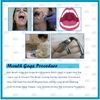 DDP Molt Mouth Gag Anesthesia Instruments 5.5" Silver