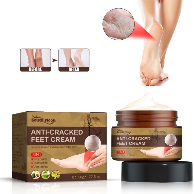 Fußcreme, Crema Reparadora de Talones, Crema de Pies para Talones Secos y Agrietados, für Trockene, Rissige Füße, Hände, Fersen, Ellbogen, Nägel, Knie, spendet,Peelt Abgestorbene Haut