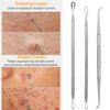7PC Blackhead Acne Comedone Pimple Blemish Extractor Stainless Remover Tool Kit