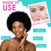Bye Bye Blemish Acne Drying Lotion, Reduce Pimples Overnight 1oz, 3-Pack