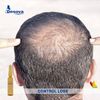 Restructuring Solution for Hair Growth Serum Mesotherapy De Nova