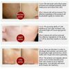 Pore Shrinkage Liquid Remove Blackhead Whitehead Acne Deep Cleansing Whitening