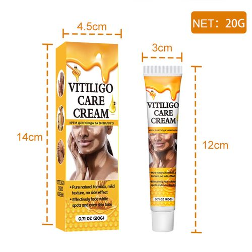 Grgowe Vitiligo Cream, White Spot Cream, Vitiligo Cream for White Spots, Vitiligo Cream, Vitiligo Skin Care Balm, Vitiligo Cream, Repigmentation Cream for White Skin Spots and Vitiligo