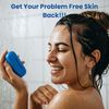 Nixoderm Antibacterial Soap For Skin Problems 120g (Cool Mint)