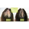 DAMO hair loss control scalp Tonic