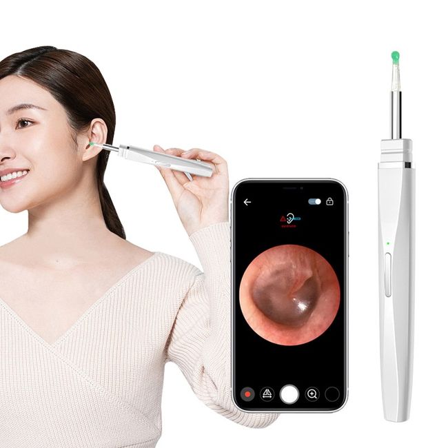 ANYOU Smartphone Ear Endoscope WIFI Connected Endoscope Smart Camera Earpick Ear Cleaning Endoscope, Blue, 1pcs, 1pcs