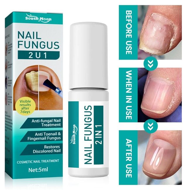 Nail Bright Pills - Nail Fungal Cure Stop Fungus Dry Brittle Crumbing Nails