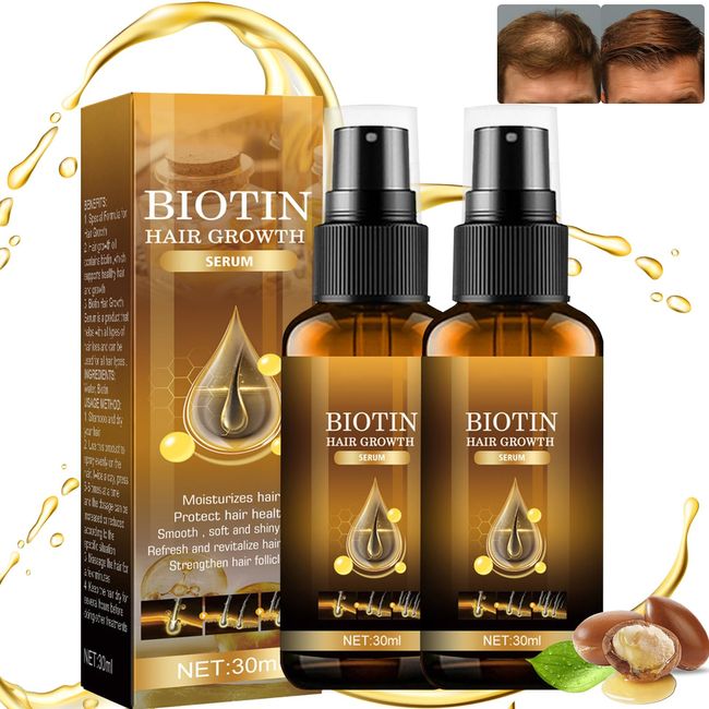 2PCS Biotin Premium Hair Growth Serum, Biotin Hair Growth Spray, Biotin Thickening Herbal Serum, Biotin Herbal Serum for Thicker Longer & Stronger Hair