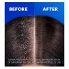 Head & Shoulders Supreme Moisture shampoo 400ml