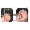 Careforyou® 18pcs Ear Plug with 6 tubes Resound BTE Hearing Aid Aids Eartips Domes