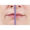 TRIPLE SMOOTH UPPER LIP WRINKLE CREAM REMOVE WRINKLES ON THE LIPS