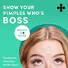 Dots for Spots Pimple Patches - Fast Acting Translucent (60 count)
