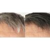 antioxidant supplement for men - GRAY HAIR – GRAPE SEED EXTRACT COMBO 2B - grape