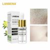 6 pack Pore Shrinkage Liquid Remove Blackhead Whitehead Acne Cleansing Whitening