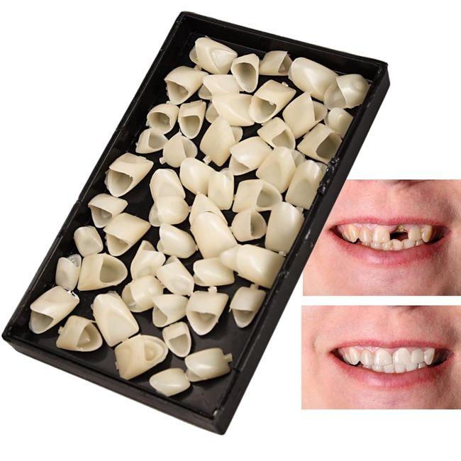 70PCS Temporary Tooth Crown, Temporary Crowns for Teeth,Fake Front Tooth Repair Kit,Temporary Tooth Replacement Kit,Denture Tooth Kit False Tooth,Dental Repair Kit Crowns,for Oral Care