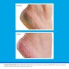 O’Keeffe’s® Jar Healthy Feet 91g (6 Pack)