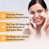 OCuSOFT Oust Demodex Foam Cleanser - Extra Strength - Foaming Cleanser for Eyeli