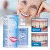 Tooth Repair Granules Temporary Kit Fitting Beads Reusable Moldable False Teet