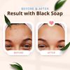 Dermatologist-Recommended Black Soap for Healthy Skin