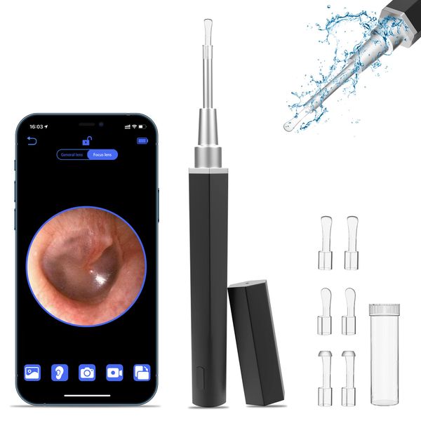 Ear Wax Removal, Ear Cleaner with Camera Earwax Remover Tool, Ear Camera Otoscope kit with Light, Ear Wax Camera with 6 Ear Spoon for Kids, Adults & Pets