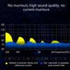 External USB-C Sound Card Type-C to 3.5mm Connector Cable Headphone Microphone Adapter