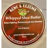 Acne & Eczema Whipped Shea Butter 12 oz