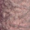 Semperfli EggStatic Egg Fritz 8mm - Powder Pink