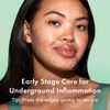 Rael Hydrocolloid Pimple Patches, Miracle Invisible Spot & Microcrystal Bundle
