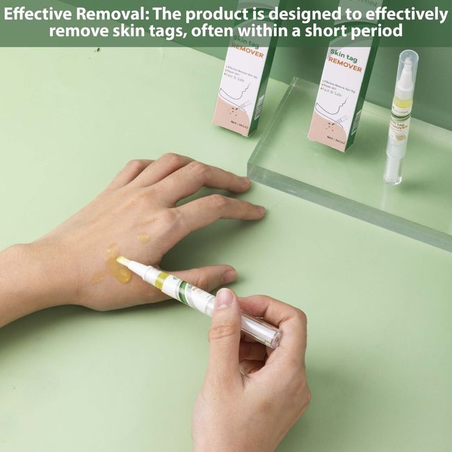 Skin Tag Remover Pen