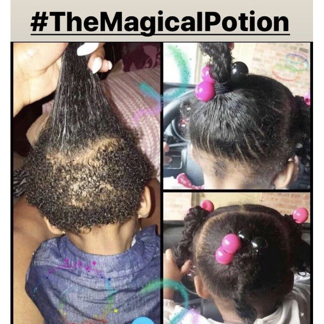 #TheMagicalPotion Hair Growth Formula