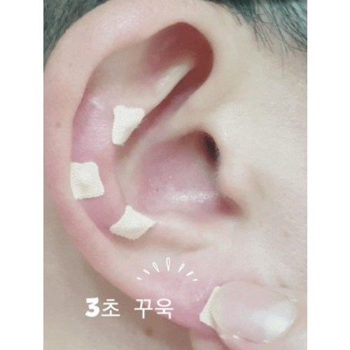 Front-of-house store all-purpose ear acupressure patch (1+1 1,200 pieces) + acupressure stick set [includes acupuncture point guide]