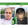 120ml Neo Hair Lotion 100% Original Authentic