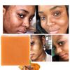 2 Pack Tumeric Soap Acne Dark Spots Removal Skin Whitening Body Bleaching Soap