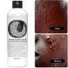 Dermatologist-Recommended Black Soap for Healthy Skin