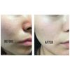 1% HYALURONIC ACID SOLUTION BY BELLAHUT - 4 OZ.