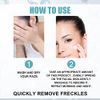 Dark Spot Remover For Face, Hyperpigmentation Treatment, Dark Spot Serum, Melasma treatment for face, Blemish spot treatment, Freckle Remover for Sun Spots, Acne Scars, Melasma for Men & Women, 30g