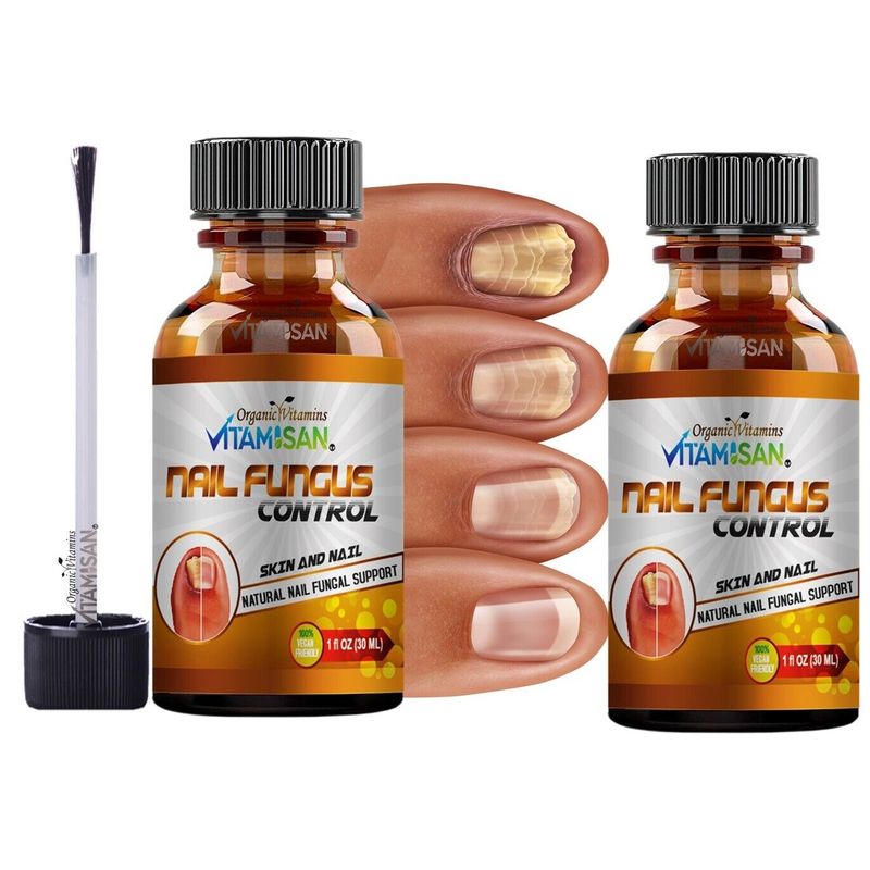 Toenail Fungus Treatment,Toe Fungus Nail Treatment Extra