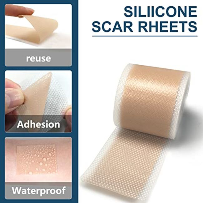 Medical Silicone Tape,Silicone Roll ,Silicone Roll for old and new