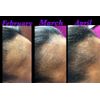 Amazing Hair Growth Serum