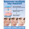 Nicotinamide Freckles Removing Cream
