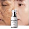 Dark Spot Remover