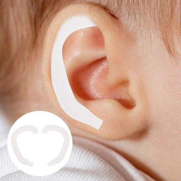 Ear Correction Corrector Neonatal Auricle Protrusion Deformity Premium Fixed Silicone, White